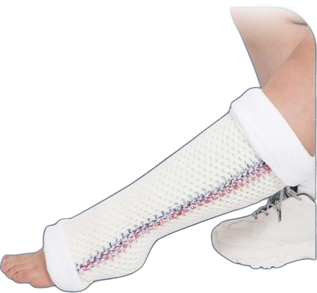 BX sleeve cast fitted on a lower leg, from ankle to below the knee